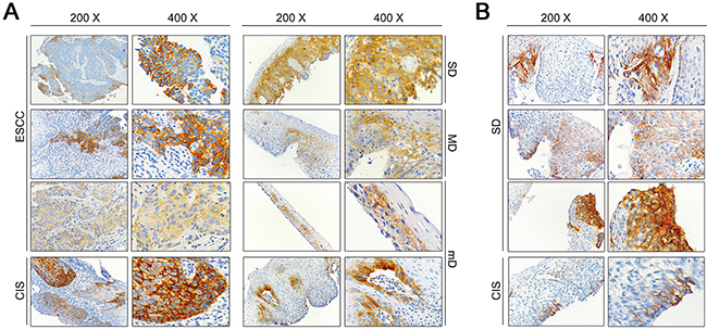 Figure 3. Representative immunohistochemical results of ANO1 positive staining.