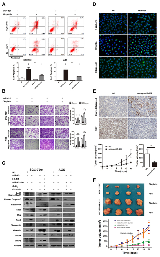 Overexpression of miR-421 promotes metastasis, inhibits apoptosis, and induces cisplatin resistance in gastric cancer.