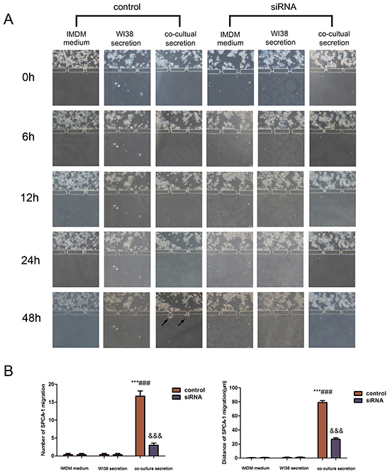 Changes in SPCA-1cell invasion capacity in the 3D microfluidic device.