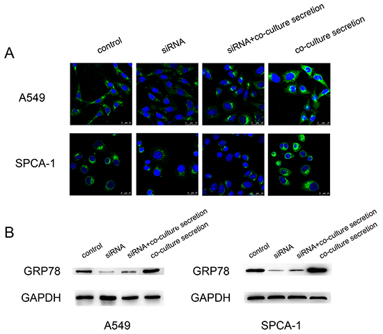 Upregulation of GRP78 expression in NSCLC cell lines after cultured with the CAFs-conditioned medium.