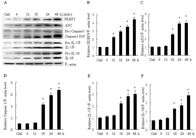 Aldo time-dependent activated NLRP3 inflammasome in HK-2 cells.