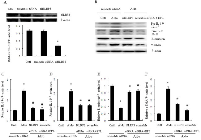 Transfection with siNLRP3 or treatment with EPL inhibits Aldo-induced NLRP3 inflammasome and phenotypic alternation in HK-2 cells.