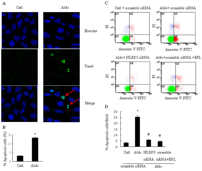 siNLRP3 and EPL inhibit Aldo-induced apoptosis in HK-2 cells.
