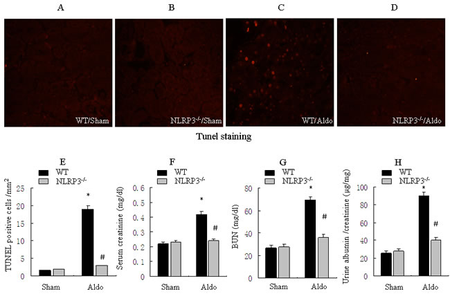 Knockout of NLRP3 ameliorates Aldo-induced tubular epithelial cell apoptosis and renal function in mice treated with Aldo-infusion.