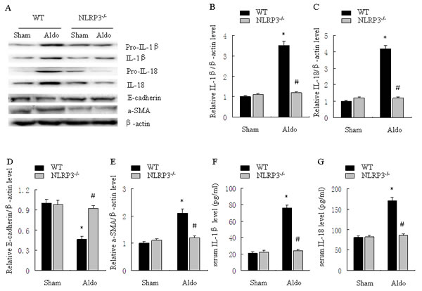 Knockout of NLRP3 ameliorates Aldo-induced activation of the NLRP3 inflammasome and phenotypic alternation in mice treated with Aldo-infusion.