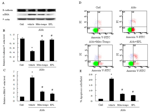 Treatment with Mito-Tempo or EPL inhibits Aldo-induced cell phenotypic alternation and apoptosis in HK-2 cells.