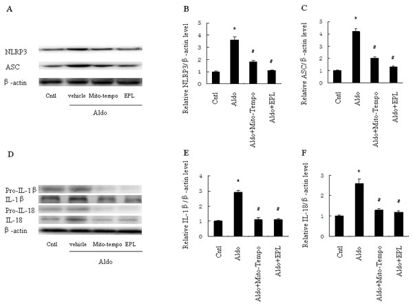 Treatment with Mito-Tempo or EPL inhibited Aldo-induced activation of the NLRP3 inflammasome in HK-2 cells.