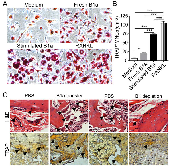 RANKL-expressing B1a cells promote osteoclastogenesis both