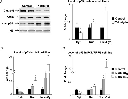 Subcellular localization of p53 protein in preneoplastic livers in rats undergoing hepatocarcinogenesis and in HCC cell lines.