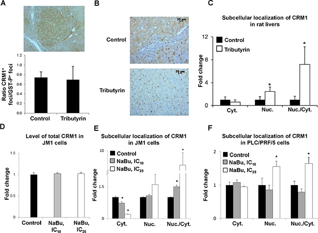 Subcellular localization of CRM1 protein in preneoplastic livers in rats undergoing hepatocarcinogenesis and in HCC cell lines.