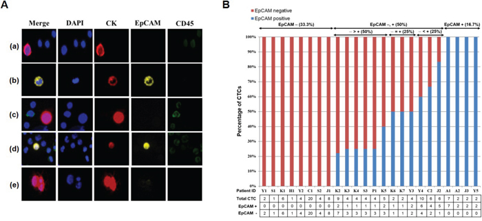 Isolation of CTCs from metastatic breast cancer patients using the p-MOFF chip.