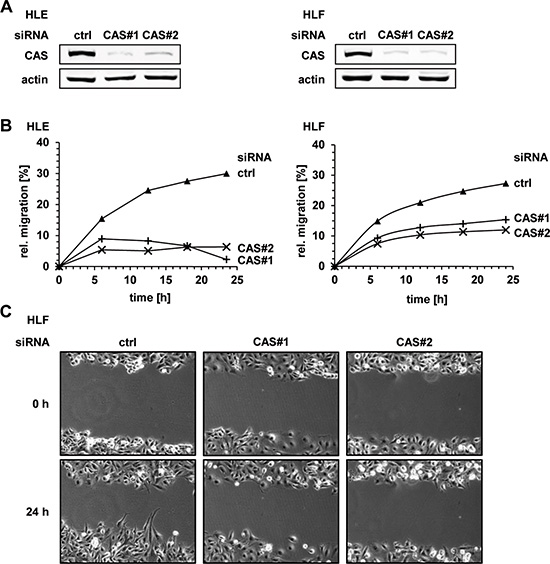 CAS is essential for migration of HCC cells in vitro.