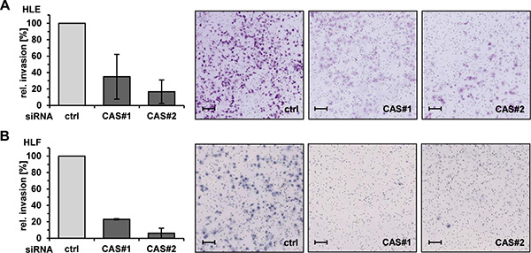 CAS is essential for invasion of HCC cells in vitro.