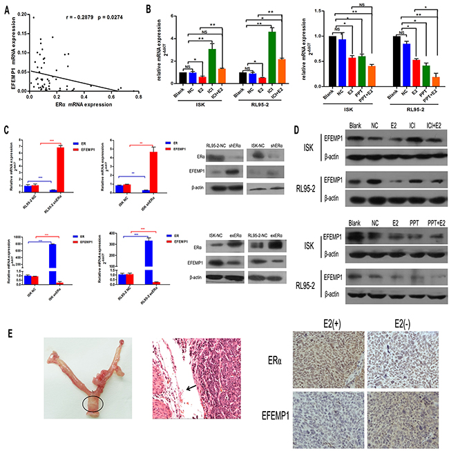 17&#x03B2;-estrogen inhibits the expression of EFEMP1 in EC tissues and cells.