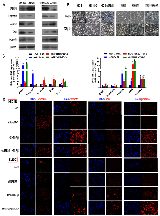 EFEMP1 suppresses EMT in EC cells.