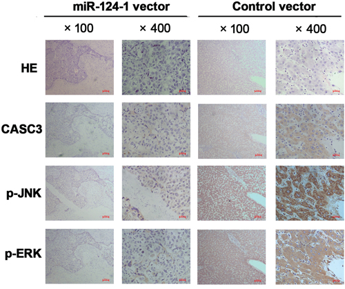 Immunohistochemistry was performed on HCC tissues from orthotopical implantation models of miR-124-1 vector and control vector transfected MHCC-LM3 cells for CASC3, p-JNK, and p-ERK.
