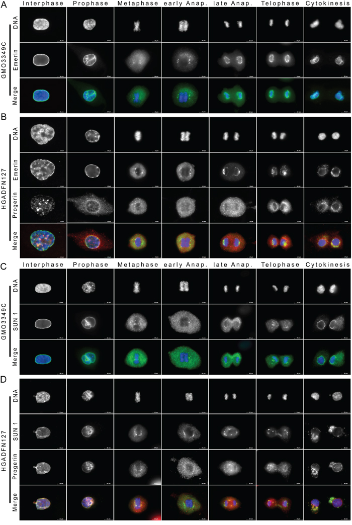 Emerin and SUN1 distribution are altered in mitotic HGPS fibroblasts.
