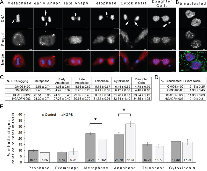 Frequent chromatin lagging occurred in mitotic HGPS cells.