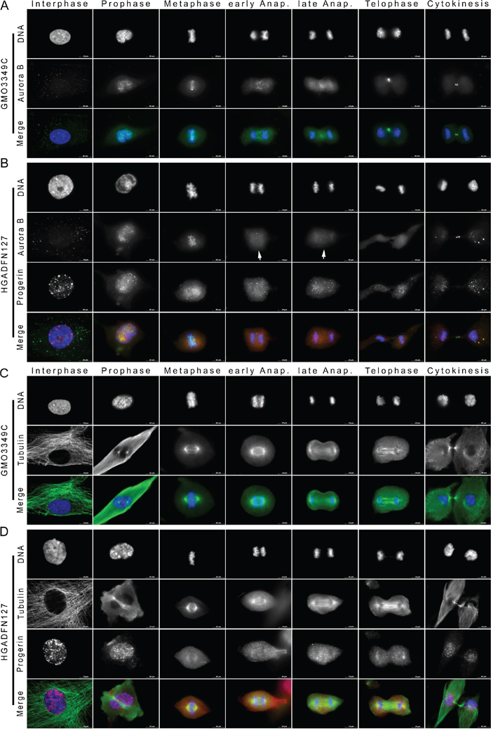 Aurora kinase B distribution is altered in mitotic HGPS cells.