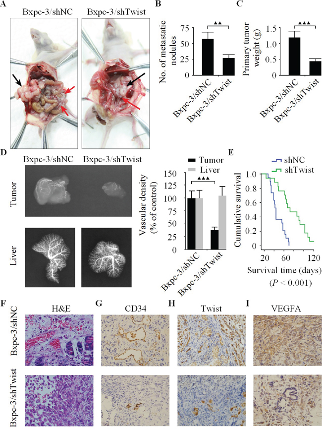 The down-regulation of Twist represses pancreatic cancer cell growth, metastasis and angiogenesis in vivo.