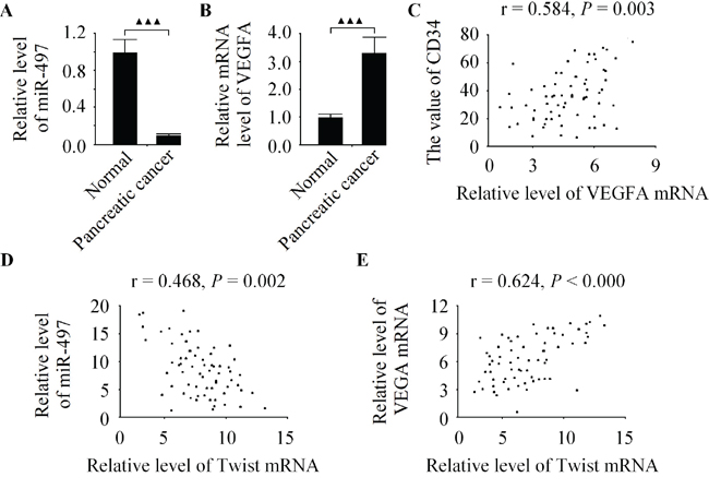 The level of Twist is positively correlated with VEGFA expression in pancreatic cancer specimens.
