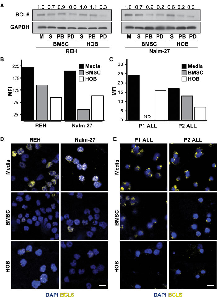 Co-culture with BMSC or HOB reduces BCL6 in ALL cells.