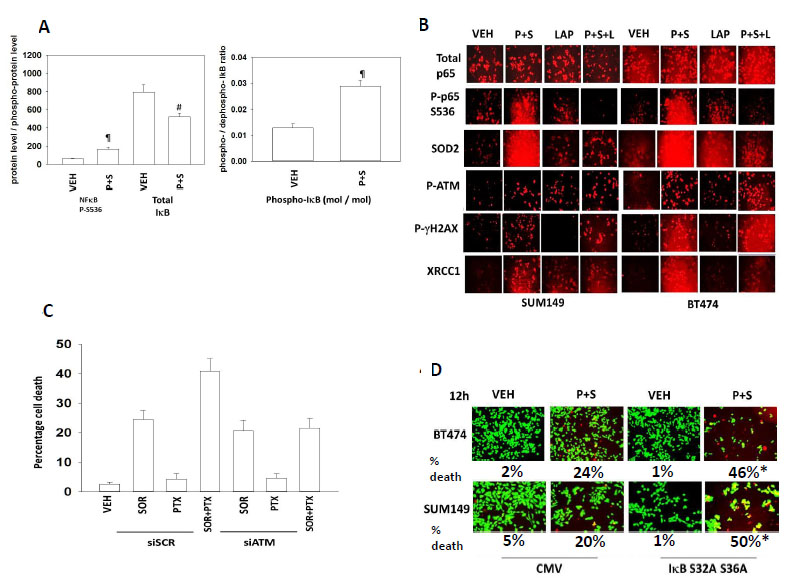 Inhibition of NF&#x3ba;B signaling prevents induction of SOD2 expression and enhances tumor cell killing by [Pemetrexed and Sorafenib]; [Pemetrexed + Sorafenib] causes a prolonged activation of ATM which promotes tumor cell killing.