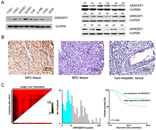 Expression of ARHGEF3 in nasopharyngeal cell lines and tissues and its prognostic significance in nasopharyngeal carcinoma (NPC) patients.