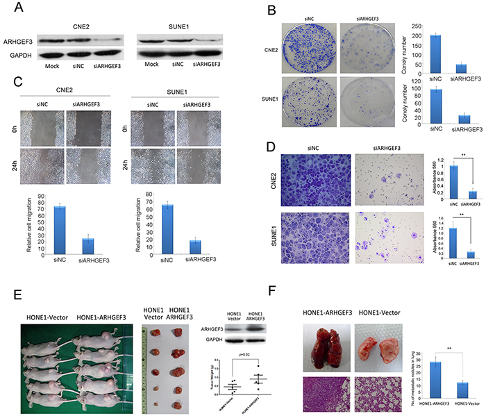 Effect of ARHGEF3 on NPC cells colony formation, cell motility, and invasion in vitro and tumorigenesis and metastasis in vivo.
