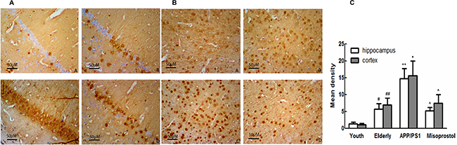 Changes of mPGES-1 expression in hippocampus and cortex (&#x00D7; 400).