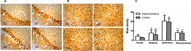 Changes of EP2 expression in hippocampus and cortex (&#x00D7; 400).