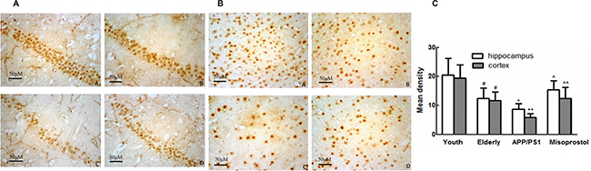 Changes of EP3 expression in hippocampus and cortex (&#x00D7; 400).
