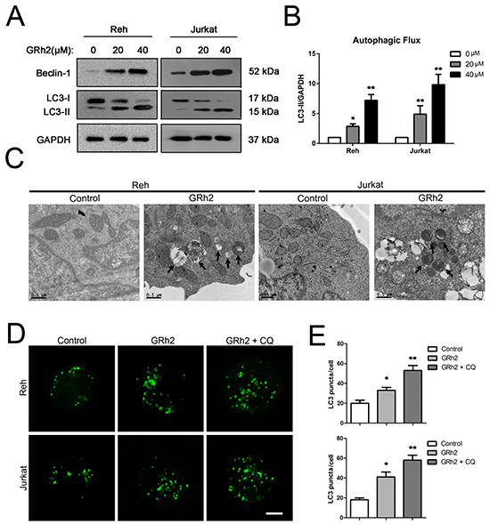 20(S)-GRh2 induces autophagy in ALL cells.