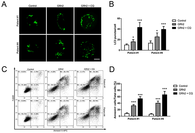 Autophagy plays a protective role in 20(S)-GRh2-induced apoptosis in human primary ALL cells.