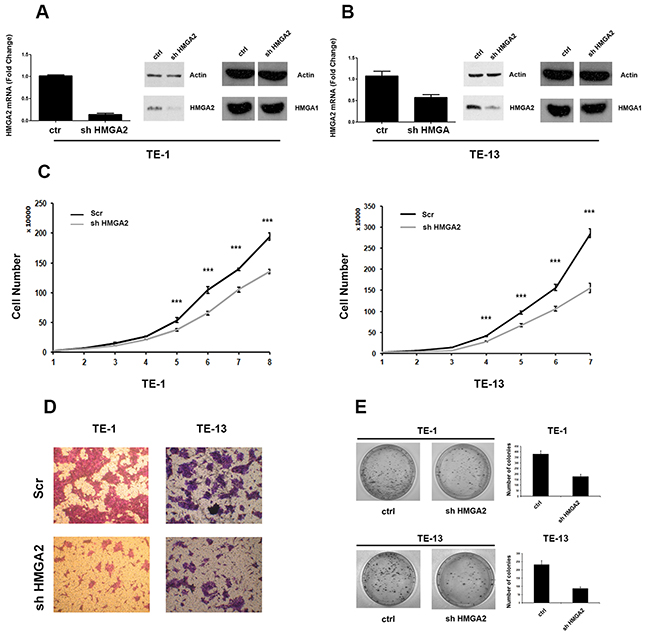 HMGA2 silencing inhibits TE-1 and TE-13 cells growth and migration.