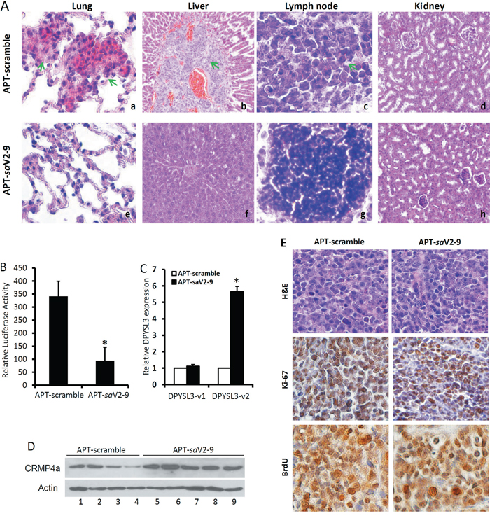 A10-3.2-saV2-9 conjugates suppress xenograft tumor metastasis in vivo.