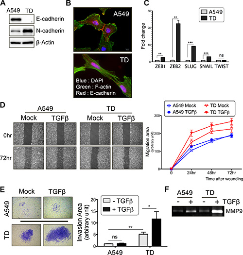 Chronic TGF&#x03B2; stimulation enhances tumor cell migration and invasion.