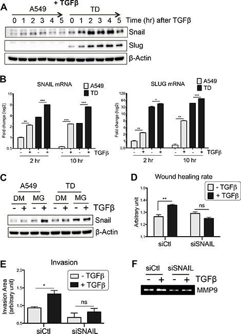 Increased Snail protein stability in TD cells.