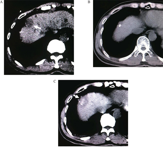 Figure 3: