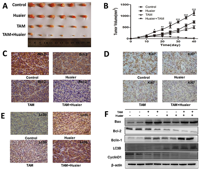 Combined treatment enhanced the suppression of tumorigenesis in a xenograft model.