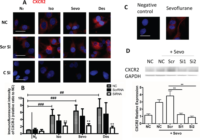 Expression of CXCR2 is increased in ovarian cancer upon exposure to volatile anaesthetics.
