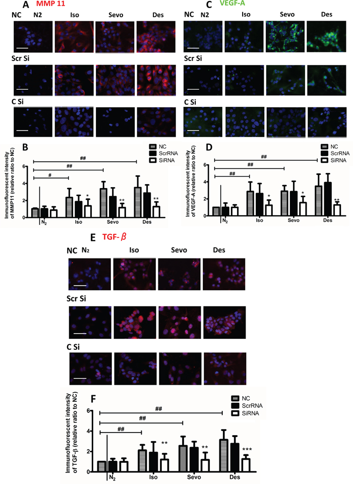 Upregulation of VEGF-A, MMP11 and TGF-&#x03B2; in ovarian cancer cells upon exposure to volatile anaesthetics.