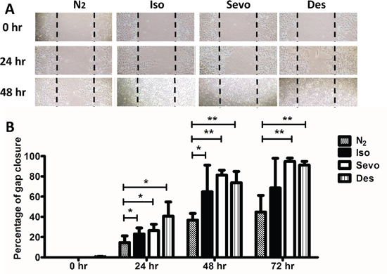 Migration of SKOV3 cells is increased after exposure to volatile anaesthetics.