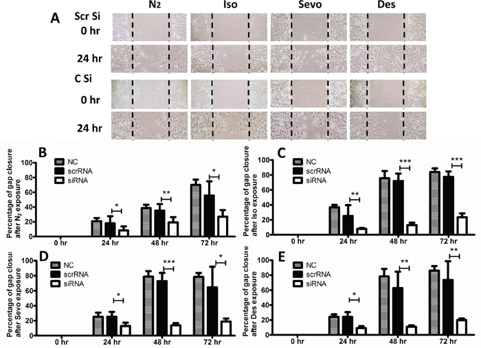 CXCR-2 siRNA abolished effects of inhalational anaesthetics on SK-OV3 cell migration.