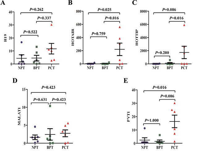The expression of putative lncRNA biomarkers in pancreatic tissues.