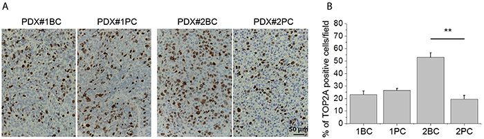 Expression of TOP2A protein in the PDXs.