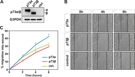 p73&#946;, but not p73&#945; expression, inhibits cell migration.