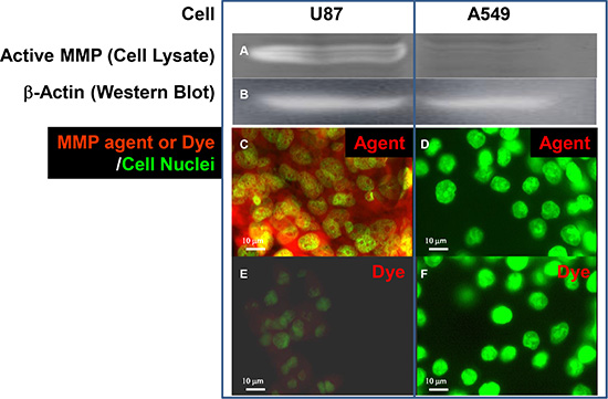 Detection of active MMP by zymography and with MMP-targeting agent.