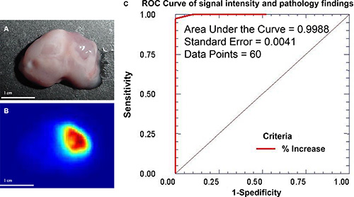 Change in MMP signal intensity can be used to determine sensitivity and specificity of the tumor cell detection.