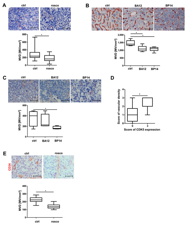 Pharmacological inhibition of CDK5 reduces vascular density in different murine liver tumor models.